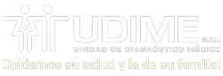 Udime